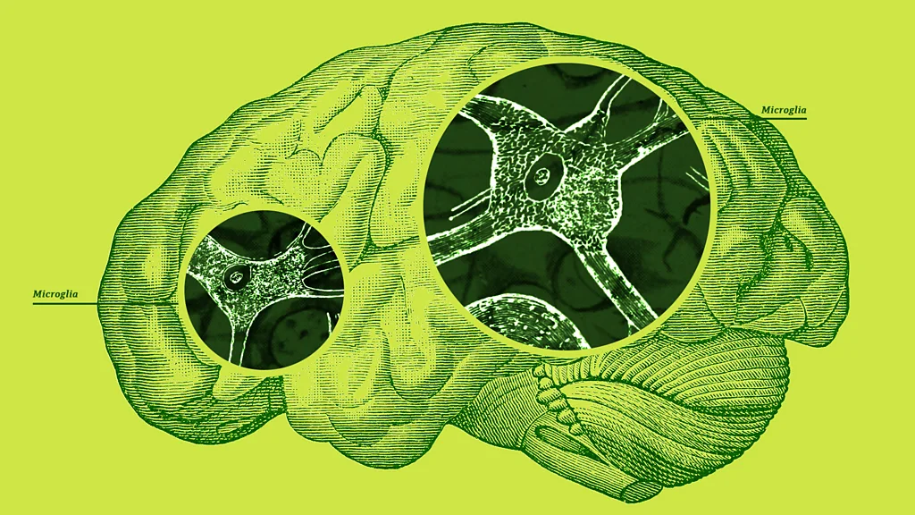 Microglia in the brain related to disease.